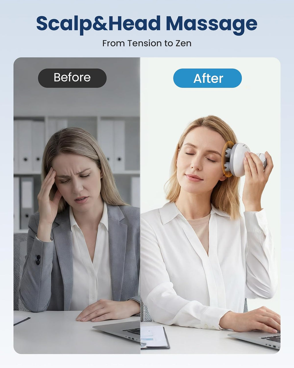 Smart Scalp Massager – Relaxing Head & Scalp Massage Device