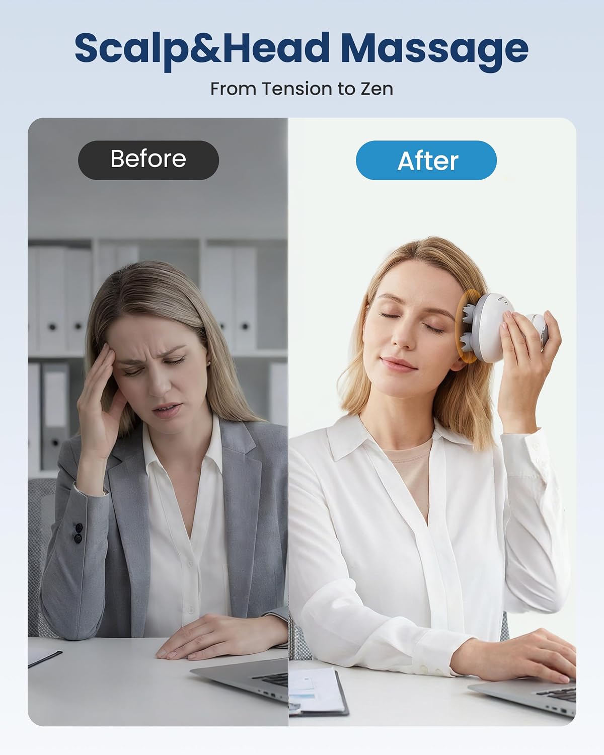 Smart Scalp Massager – Relaxing Head & Scalp Massage Device